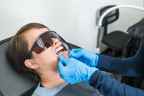 Best Knocked-Out Tooth (Avulsed Tooth) Treatment in Lake Linden, MI